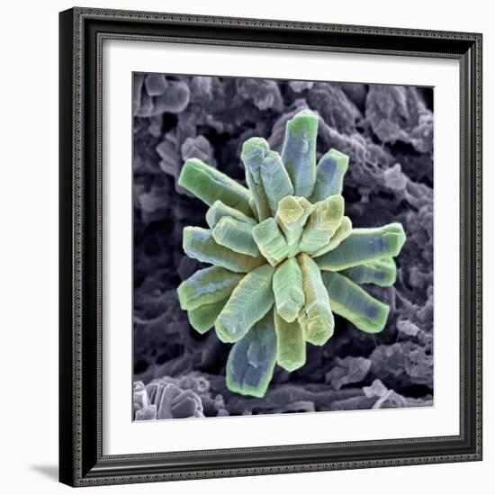 Calcium Phosphate Crystal, SEM-Steve Gschmeissner-Framed Premium Photographic Print