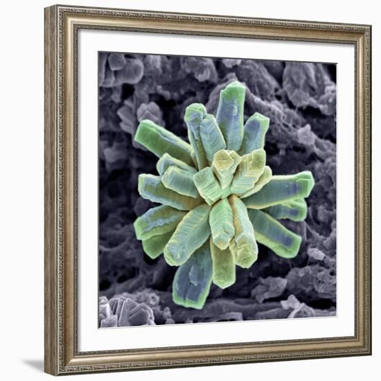 Calcium Phosphate Crystal, SEM-Steve Gschmeissner-Framed Photographic Print