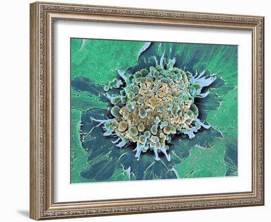 Cancer Cell Apoptosis, SEM-Steve Gschmeissner-Framed Photographic Print