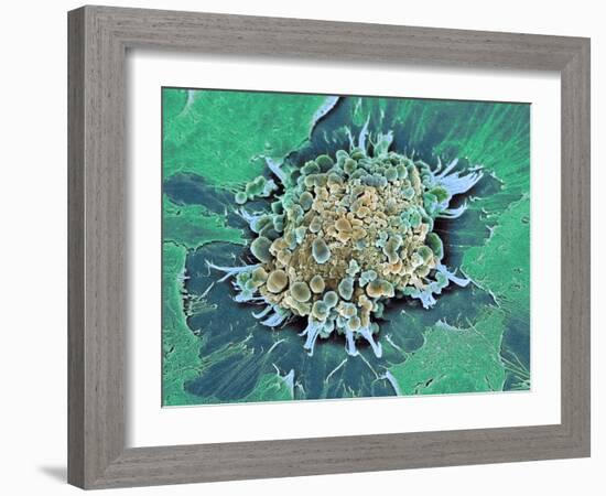 Cancer Cell Apoptosis, SEM-Steve Gschmeissner-Framed Photographic Print