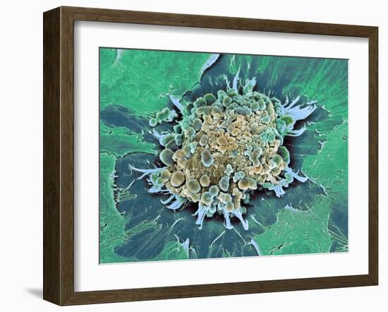 Cancer Cell Apoptosis, SEM-Steve Gschmeissner-Framed Photographic Print