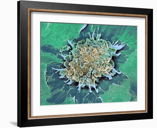 Cancer Cell Apoptosis, SEM-Steve Gschmeissner-Framed Photographic Print