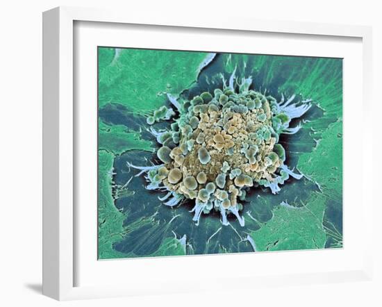 Cancer Cell Apoptosis, SEM-Steve Gschmeissner-Framed Photographic Print