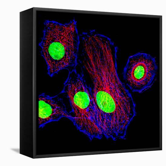 Cancer Cell Division-Dr. Paul Andrews-Framed Premier Image Canvas