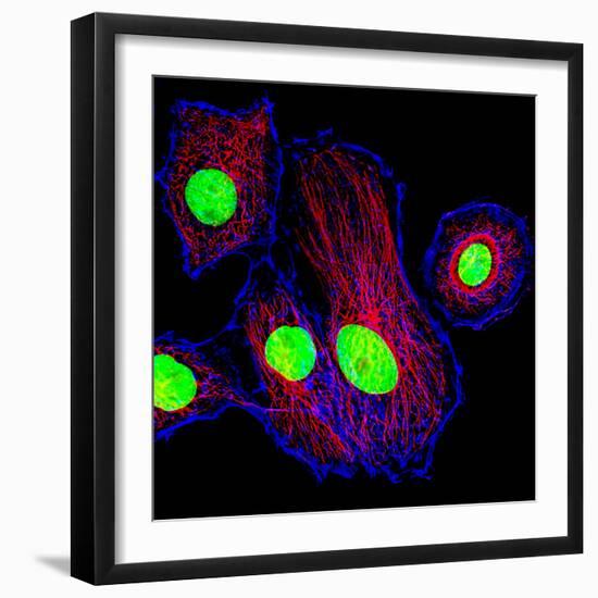 Cancer Cell Division-Dr. Paul Andrews-Framed Premium Photographic Print