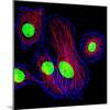 Cancer Cell Division-Dr. Paul Andrews-Mounted Premium Photographic Print