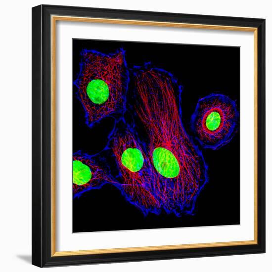 Cancer Cell Division-Dr. Paul Andrews-Framed Premium Photographic Print