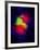 Cancer Cell Division-Dr. Paul Andrews-Framed Photographic Print
