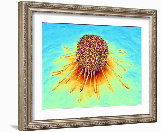 Cancer Cell-PASIEKA-Framed Photographic Print