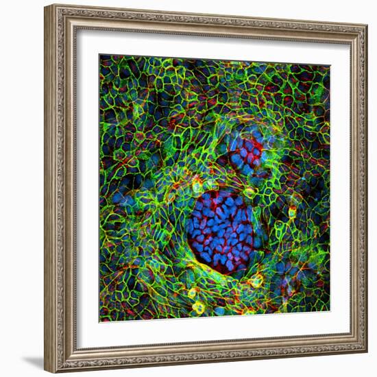 Cancer Cells, Light Micrograph-Science Photo Library-Framed Premium Photographic Print