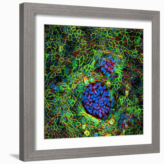 Cancer Cells, Light Micrograph-Science Photo Library-Framed Premium Photographic Print