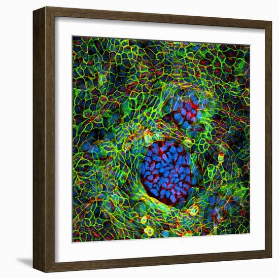 Cancer Cells, Light Micrograph-Science Photo Library-Framed Premium Photographic Print