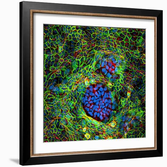 Cancer Cells, Light Micrograph-Science Photo Library-Framed Premium Photographic Print