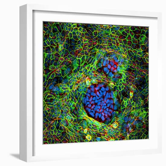 Cancer Cells, Light Micrograph-Science Photo Library-Framed Premium Photographic Print