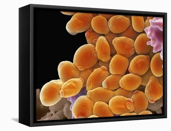 Candida Albicans Yeast Cells, SEM-Steve Gschmeissner-Framed Premier Image Canvas