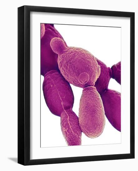 Candida Albicans Yeast, SEM-Science Photo Library-Framed Photographic Print