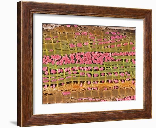 Cardiac Muscle, SEM-Steve Gschmeissner-Framed Photographic Print