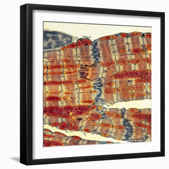 Cardiac Muscle, TEM-Thomas Deerinck-Framed Premium Photographic Print