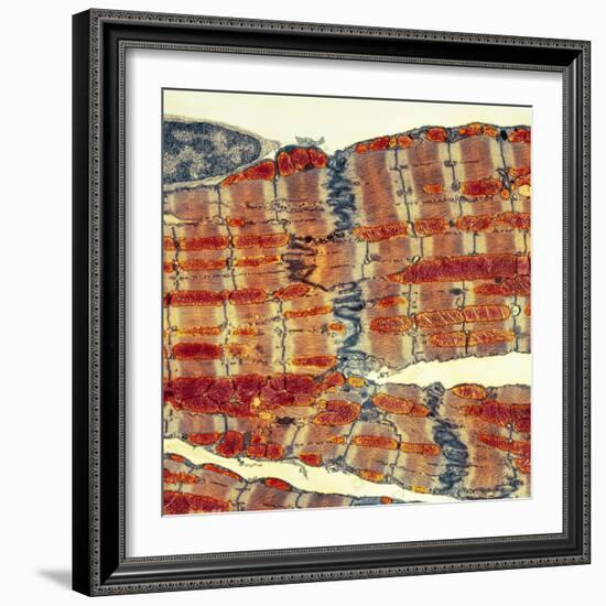 Cardiac Muscle, TEM-Thomas Deerinck-Framed Premium Photographic Print