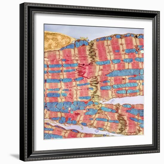 Cardiac Muscle, TEM-Thomas Deerinck-Framed Premium Photographic Print