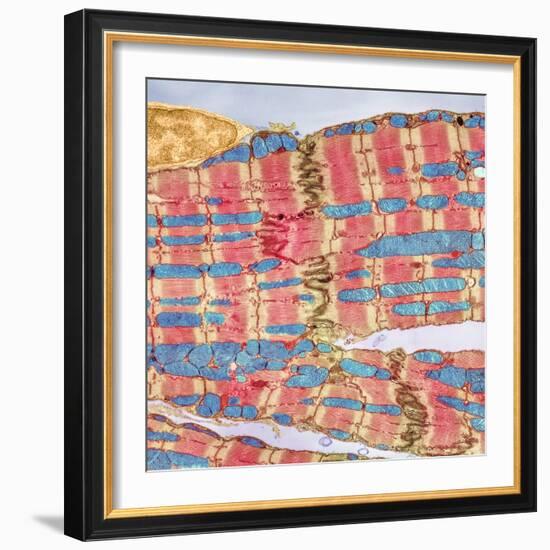 Cardiac Muscle, TEM-Thomas Deerinck-Framed Premium Photographic Print