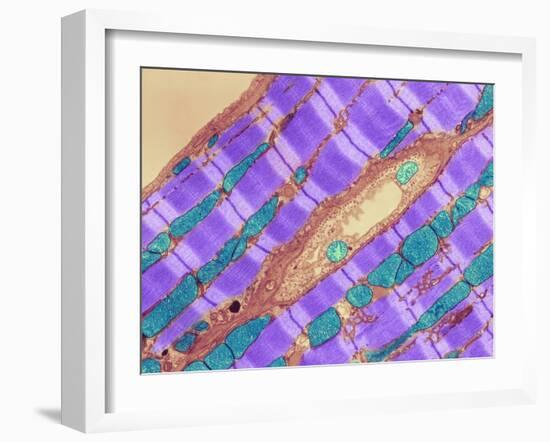 Cardiac Muscle, TEM-Thomas Deerinck-Framed Photographic Print