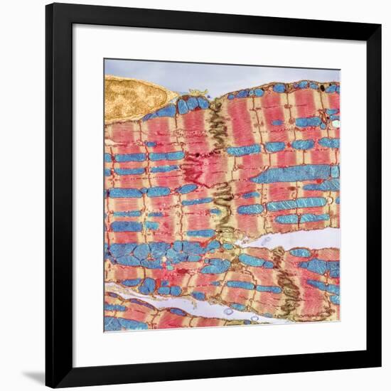 Cardiac Muscle, TEM-Thomas Deerinck-Framed Photographic Print