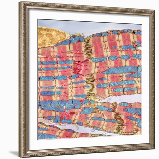 Cardiac Muscle, TEM-Thomas Deerinck-Framed Photographic Print