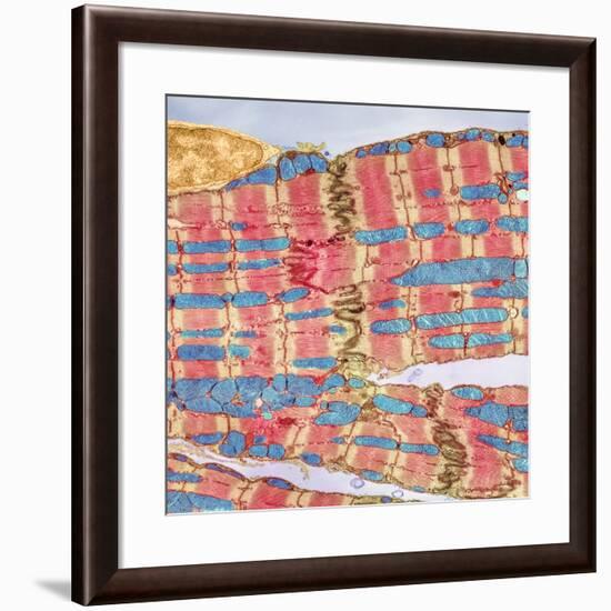 Cardiac Muscle, TEM-Thomas Deerinck-Framed Photographic Print