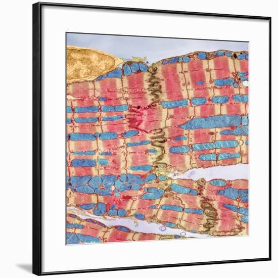 Cardiac Muscle, TEM-Thomas Deerinck-Framed Photographic Print