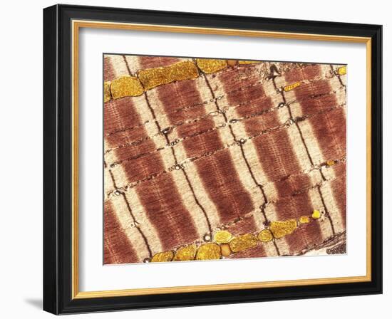 Cardiac Muscle, TEM-Thomas Deerinck-Framed Photographic Print