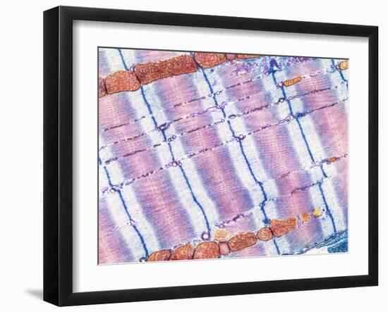 Cardiac Muscle, TEM-Thomas Deerinck-Framed Photographic Print