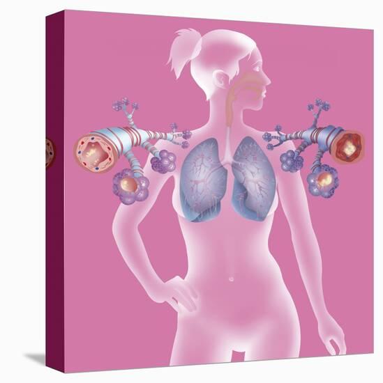 Stretched Canvas Print, , large