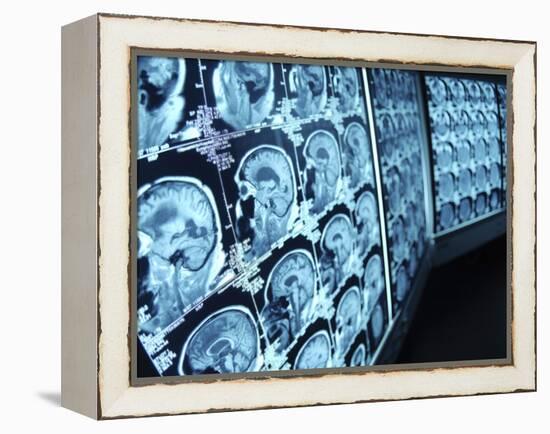 Cat Scan Images of Brain-null-Framed Premier Image Canvas