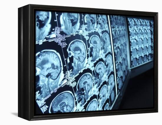 Cat Scan Images of Brain-null-Framed Premier Image Canvas