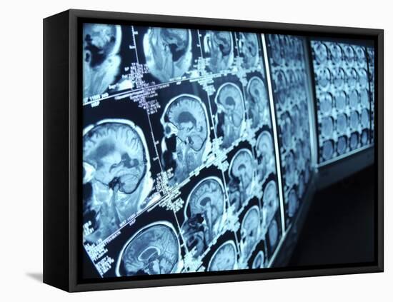 Cat Scan Images of Brain-null-Framed Premier Image Canvas