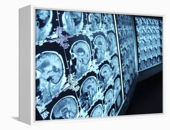 Cat Scan Images of Brain-null-Framed Premier Image Canvas