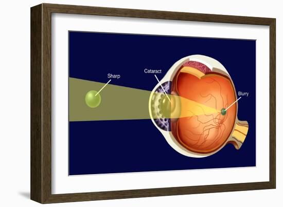 Cataract-Spencer Sutton-Framed Giclee Print