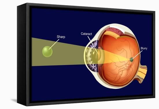 Cataract-Spencer Sutton-Framed Premier Image Canvas