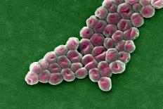 Acinetobacter Baumannii Bacteria, SEM-CDC-Mounted Photographic Print