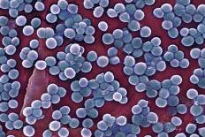Acinetobacter Baumannii Bacteria, SEM-CDC-Framed Premier Image Canvas
