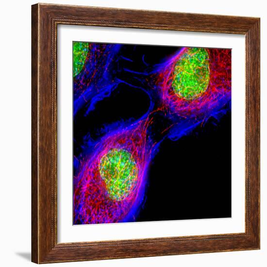 Cell Division-Dr. Paul Andrews-Framed Premium Photographic Print