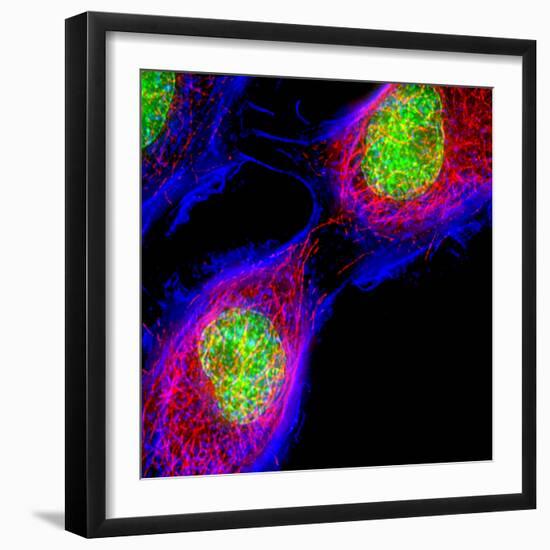 Cell Division-Dr. Paul Andrews-Framed Premium Photographic Print