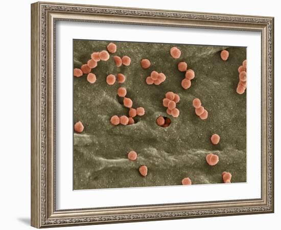 Cell Infected with HIV, SEM-Thomas Deerinck-Framed Photographic Print