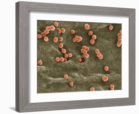 Cell Infected with HIV, SEM-Thomas Deerinck-Framed Photographic Print