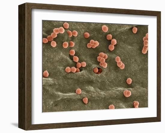 Cell Infected with HIV, SEM-Thomas Deerinck-Framed Photographic Print
