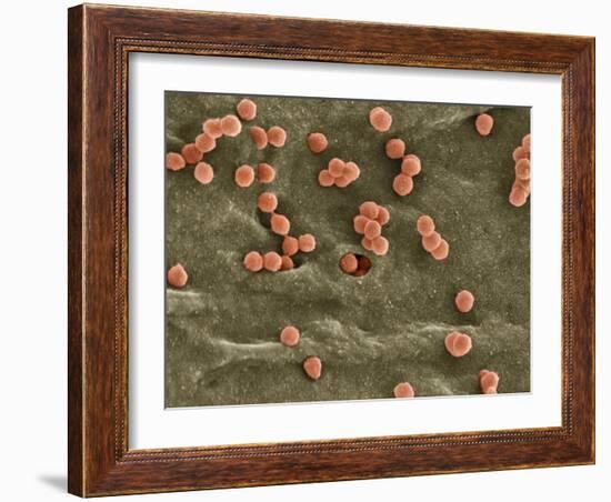 Cell Infected with HIV, SEM-Thomas Deerinck-Framed Photographic Print