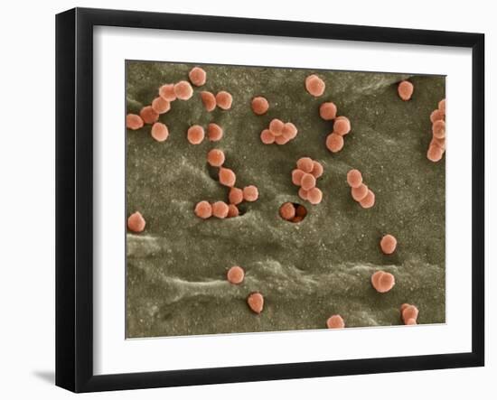 Cell Infected with HIV, SEM-Thomas Deerinck-Framed Photographic Print