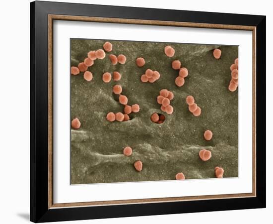 Cell Infected with HIV, SEM-Thomas Deerinck-Framed Photographic Print