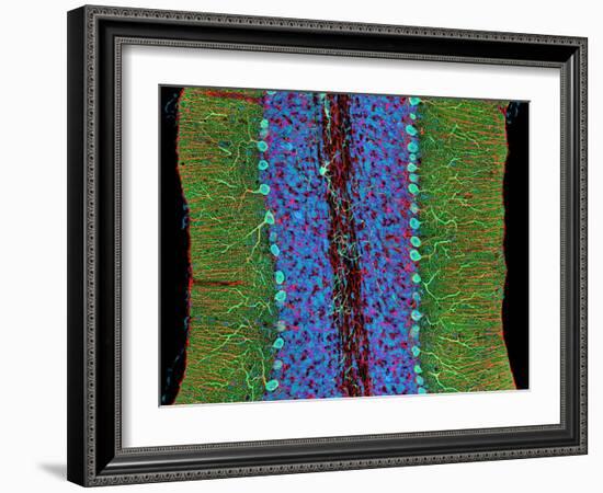 Cerebellum Tissue, Light Micrograph-Thomas Deerinck-Framed Photographic Print